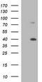 Uracil Phosphoribosyltransferase Homolog antibody, TA506871S, Origene, Western Blot image 