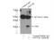 Deoxyguanosine kinase, mitochondrial antibody, 16459-1-AP, Proteintech Group, Immunoprecipitation image 