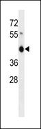 Zinc Finger Protein 843 antibody, 58-451, ProSci, Western Blot image 