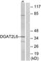 Diacylglycerol O-Acyltransferase 2 Like 6 antibody, PA5-39132, Invitrogen Antibodies, Western Blot image 