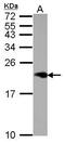 ME1 antibody, GTX109217, GeneTex, Western Blot image 