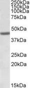 FA Complementation Group L antibody, NBP1-49839, Novus Biologicals, Western Blot image 