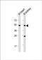 Phosphatidylinositol Glycan Anchor Biosynthesis Class U antibody, PA5-72289, Invitrogen Antibodies, Western Blot image 