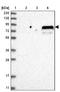 SOGA Family Member 3 antibody, NBP1-90575, Novus Biologicals, Western Blot image 