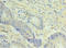 Non-SMC Condensin I Complex Subunit H antibody, LS-C377520, Lifespan Biosciences, Immunohistochemistry paraffin image 