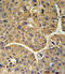 Complement factor H-related protein 5 antibody, 62-009, ProSci, Immunohistochemistry frozen image 