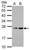 Ras-related protein Rab-39B antibody, NBP2-20044, Novus Biologicals, Western Blot image 