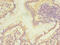 Carboxymethylenebutenolidase Homolog antibody, A58598-100, Epigentek, Immunohistochemistry paraffin image 