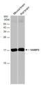 Vesicle Associated Membrane Protein 2 antibody, GTX133241, GeneTex, Western Blot image 