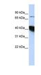 CBP80/20-dependent translation initiation factor antibody, NBP1-57423, Novus Biologicals, Western Blot image 