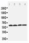 Solute Carrier Family 22 Member 7 antibody, PA2190, Boster Biological Technology, Western Blot image 