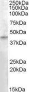 Ras association domain-containing protein 8 antibody, NBP1-00233, Novus Biologicals, Western Blot image 
