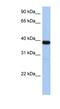 Zinc Finger Protein 781 antibody, NBP1-79421, Novus Biologicals, Western Blot image 