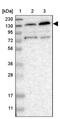 Zinc finger RNA-binding protein antibody, PA5-53470, Invitrogen Antibodies, Western Blot image 