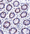 Deoxyuridine Triphosphatase antibody, LS-C167581, Lifespan Biosciences, Immunohistochemistry frozen image 