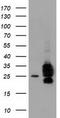 Caseinolytic Mitochondrial Matrix Peptidase Proteolytic Subunit antibody, TA502063S, Origene, Western Blot image 