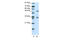 PHD Finger Protein 1 antibody, ARP33028_T100, Aviva Systems Biology, Western Blot image 