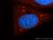 Casein kinase I isoform delta antibody, 14388-1-AP, Proteintech Group, Immunofluorescence image 