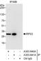 Ribosomal Protein S3 antibody, A303-840A, Bethyl Labs, Immunoprecipitation image 