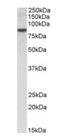 E3 ubiquitin-protein ligase TRIM36 antibody, orb18537, Biorbyt, Western Blot image 