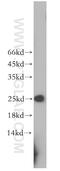 Ribulose-phosphate 3-epimerase antibody, 12168-2-AP, Proteintech Group, Western Blot image 