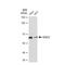 Histone Deacetylase 2 antibody, GTX01527, GeneTex, Western Blot image 
