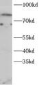 Forkhead Box O1 antibody, FNab10255, FineTest, Western Blot image 