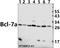 B-cell CLL/lymphoma 7 protein family member A antibody, A11664, Boster Biological Technology, Western Blot image 
