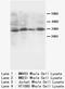 SSX Family Member 2B antibody, LS-C172044, Lifespan Biosciences, Western Blot image 