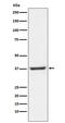 Nuclear Transcription Factor Y Subunit Alpha antibody, M03524, Boster Biological Technology, Western Blot image 