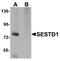 SEC14 And Spectrin Domain Containing 1 antibody, A10698, Boster Biological Technology, Western Blot image 