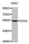 DEAD-Box Helicase 6 antibody, abx002778, Abbexa, Western Blot image 