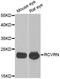 Recoverin antibody, abx004898, Abbexa, Western Blot image 