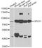 Glycosylphosphatidylinositol Specific Phospholipase D1 antibody, STJ28695, St John