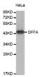 DNA Fragmentation Factor Subunit Alpha antibody, abx000734, Abbexa, Western Blot image 