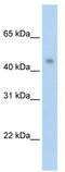 Protein Arginine Methyltransferase 8 antibody, TA345679, Origene, Western Blot image 