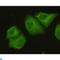 Protein Phosphatase 2 Catalytic Subunit Alpha antibody, LS-C814110, Lifespan Biosciences, Immunofluorescence image 