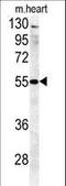 Beta-1,4-Galactosyltransferase 5 antibody, LS-C156719, Lifespan Biosciences, Western Blot image 