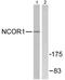Nuclear Receptor Corepressor 1 antibody, TA311667, Origene, Western Blot image 
