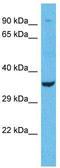 Olfactory Receptor Family 1 Subfamily L Member 1 antibody, TA337481, Origene, Western Blot image 