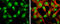 Nei Like DNA Glycosylase 2 antibody, GTX132565, GeneTex, Immunocytochemistry image 