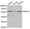 Pre-MRNA Processing Factor 4 antibody, orb373332, Biorbyt, Western Blot image 