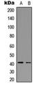 C-C Motif Chemokine Receptor 5 (Gene/Pseudogene) antibody, orb235065, Biorbyt, Western Blot image 