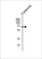 Matrix Metallopeptidase 19 antibody, LS-C164240, Lifespan Biosciences, Western Blot image 