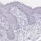 Cingulin Like 1 antibody, HPA056911, Atlas Antibodies, Immunohistochemistry paraffin image 