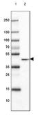 Glutamate-Ammonia Ligase antibody, NBP2-46645, Novus Biologicals, Western Blot image 