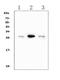 Calbindin 1 antibody, MA1007, Boster Biological Technology, Western Blot image 