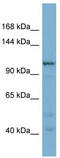 Coatomer Protein Complex Subunit Gamma 2 antibody, TA334434, Origene, Western Blot image 