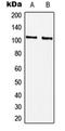 RB Binding Protein 8, Endonuclease antibody, orb215511, Biorbyt, Western Blot image 