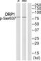 Dynamin-1-like protein antibody, AP55855PU-N, Origene, Western Blot image 